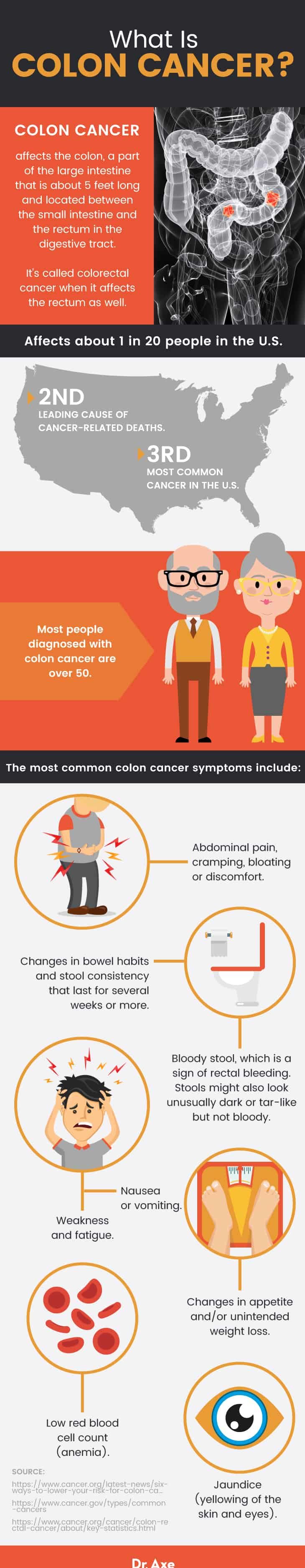 Colon cancer symptoms: what is colon cancer?