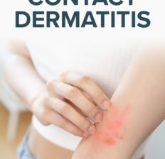 Contact dermatitis - Dr. Axe