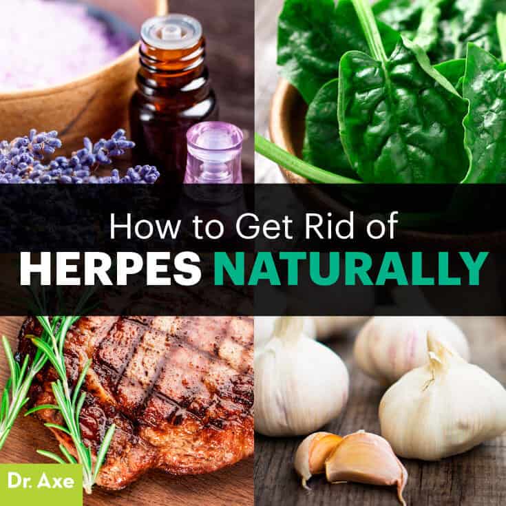 How to get rid of herpes - Dr. Axe