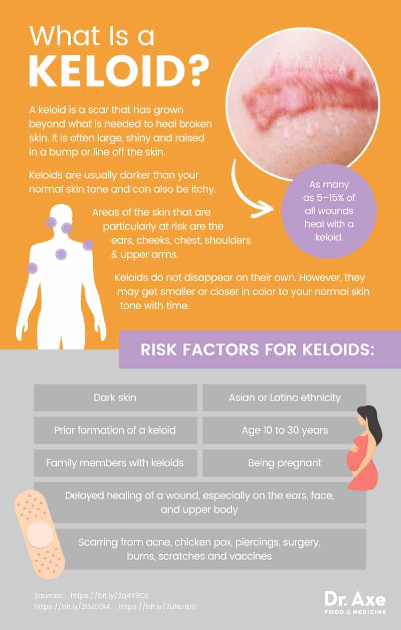 What is a keloid? - Dr. Axe